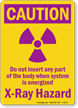 Caution X Ray Hazard Sign